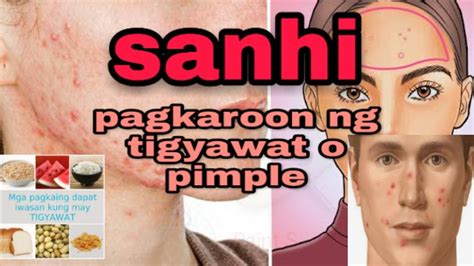 bakla tinira sa pwet|Tigyawat sa Puwit: Alamin ang Sanhi at Lunas Nito.